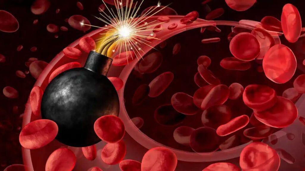 Niveles elevados de hierro / Una bomba de tiempo inesperada: la sorprendente causa de daño hepático y cáncer / Dr. Joseph Mercola